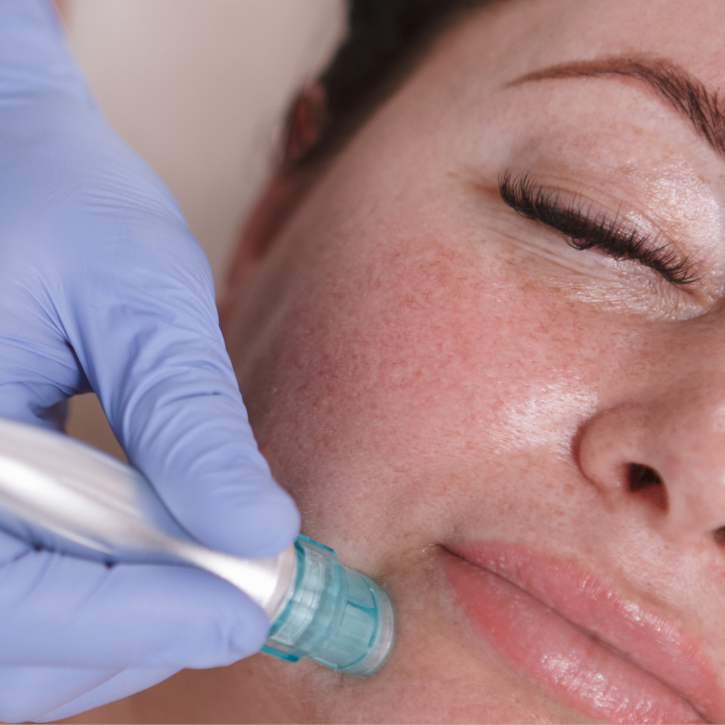 Aquapure Facial Treatment