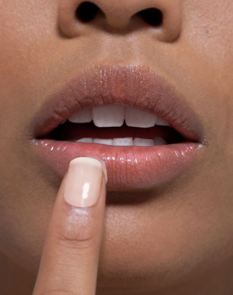 Treatment for thin lips